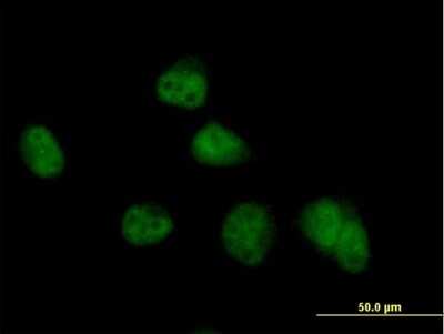 Immunocytochemistry/ Immunofluorescence: COPS8 Antibody [H00010920-B02P]