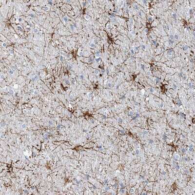 Immunohistochemistry-Paraffin: COPS8 Antibody [NBP1-84407]