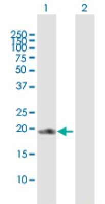 Western Blot: COPS8 Antibody [H00010920-B02P]