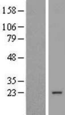 Western Blot: COPS8 Overexpression Lysate [NBL1-09385]