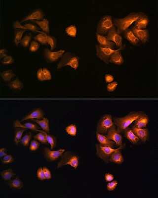 Immunocytochemistry/ Immunofluorescence: COPZ1 Antibody - Azide and BSA Free [NBP2-92058]