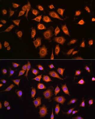 Immunocytochemistry/ Immunofluorescence: COPZ1 Antibody - Azide and BSA Free [NBP2-92058]