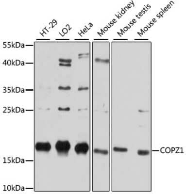 Western Blot: COPZ1 AntibodyAzide and BSA Free [NBP2-92058]