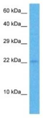 Western Blot: COPZ1 Antibody [NBP3-10793]