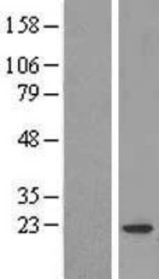 Western Blot: COPZ1 Overexpression Lysate [NBL1-09387]