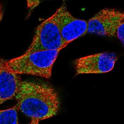 Immunocytochemistry/ Immunofluorescence: COQ10A Antibody [NBP2-56523]