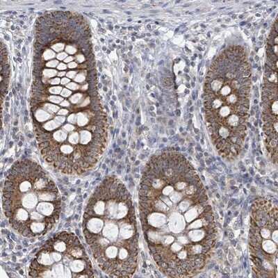 Immunohistochemistry-Paraffin: COQ10B Antibody [NBP2-14561]