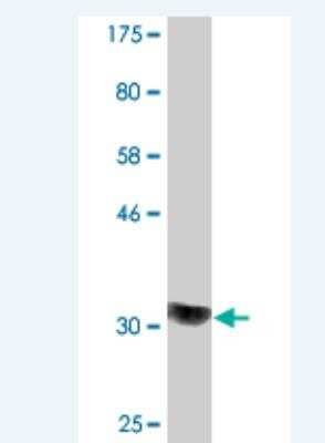 Western Blot: COQ2 Antibody (2B4) [H00027235-M03]