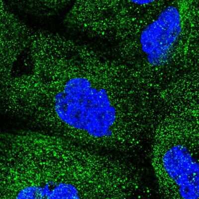 Immunocytochemistry/ Immunofluorescence: COQ2 Antibody [NBP2-56780]