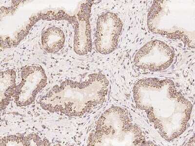 Immunohistochemistry: COQ2 Antibody [NBP3-05834]