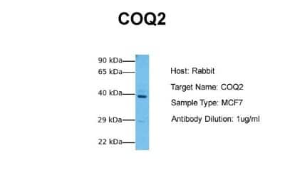 Western Blot: COQ2 Antibody [NBP1-59613]