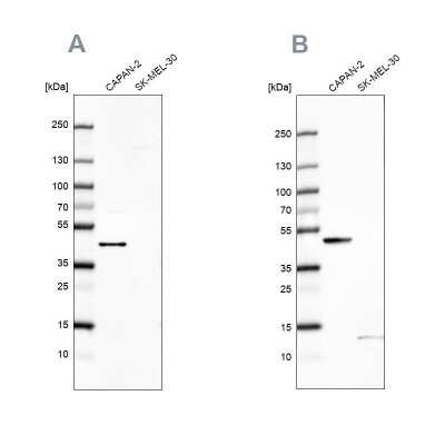 Western Blot: COQ2 Antibody [NBP2-56780]