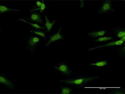 Immunocytochemistry/ Immunofluorescence: COQ3 Antibody [H00051805-D01P]