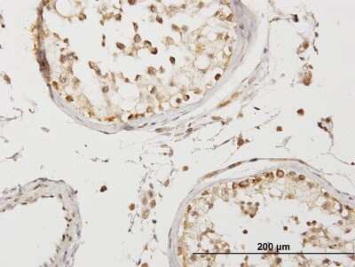 Immunohistochemistry-Paraffin: COQ3 Antibody [H00051805-B01P]