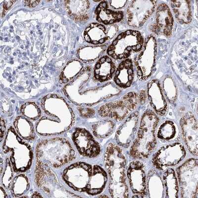 Immunohistochemistry-Paraffin: COQ3 Antibody [NBP1-88724]