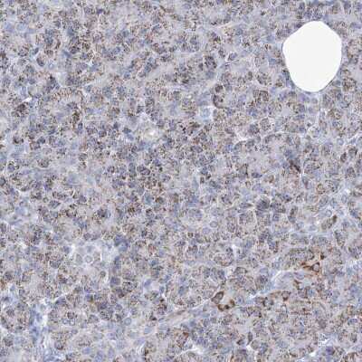 Immunohistochemistry-Paraffin: COQ3 Antibody [NBP1-88724]