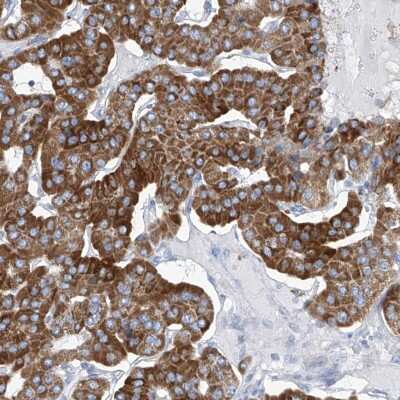 Immunohistochemistry-Paraffin: COQ3 Antibody [NBP1-88724]