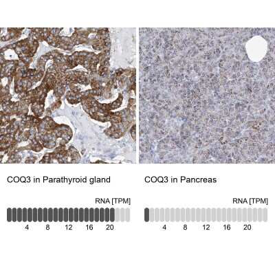 Immunohistochemistry-Paraffin: COQ3 Antibody [NBP1-88724]
