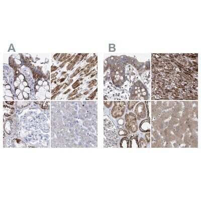 Immunohistochemistry-Paraffin: COQ3 Antibody [NBP1-88724]