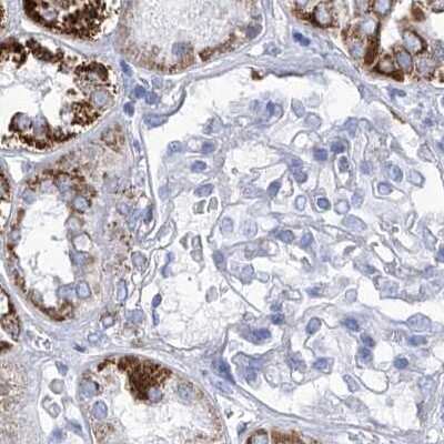 Immunohistochemistry-Paraffin: COQ3 Antibody [NBP1-88724]