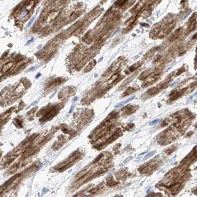 Immunohistochemistry-Paraffin: COQ3 Antibody [NBP1-88724]