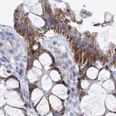 Immunohistochemistry-Paraffin: COQ3 Antibody [NBP1-88724]