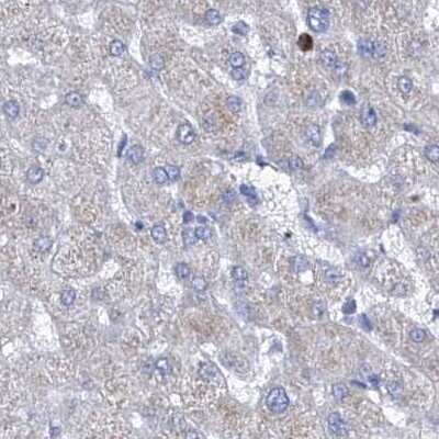 Immunohistochemistry-Paraffin: COQ3 Antibody [NBP1-88724]