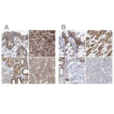Immunohistochemistry-Paraffin: COQ3 Antibody [NBP1-88725]