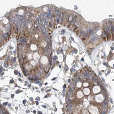 Immunohistochemistry-Paraffin: COQ3 Antibody [NBP1-88725]