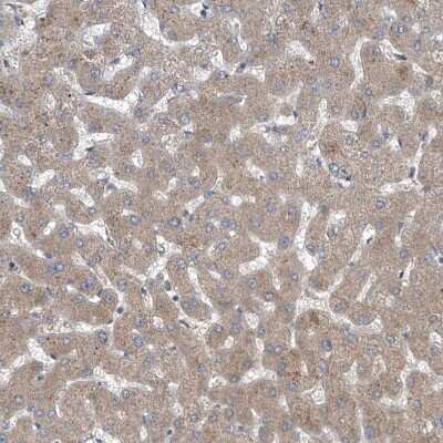 Immunohistochemistry-Paraffin: COQ3 Antibody [NBP1-88725]