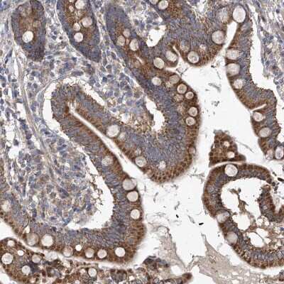 Immunohistochemistry-Paraffin: COQ3 Antibody [NBP1-88725]