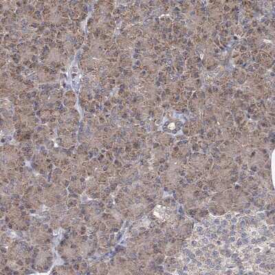 Immunohistochemistry-Paraffin: COQ3 Antibody [NBP1-88725]