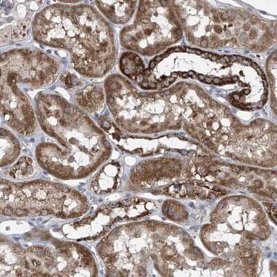 Immunohistochemistry-Paraffin: COQ3 Antibody [NBP1-88725]