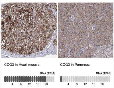 Immunohistochemistry-Paraffin: COQ3 Antibody [NBP1-88725]