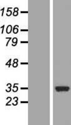 Western Blot: COQ3 Overexpression Lysate [NBL1-09390]