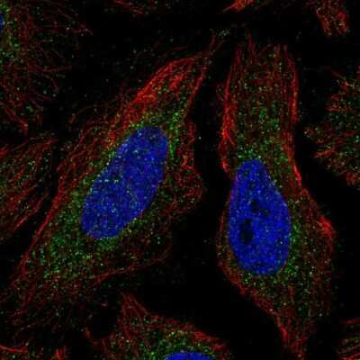 Immunocytochemistry/ Immunofluorescence: COQ4 Antibody [NBP2-58147]