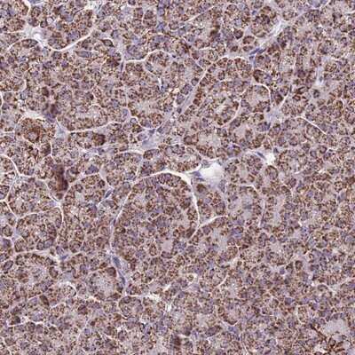 Immunohistochemistry-Paraffin: COQ4 Antibody [NBP1-91806]