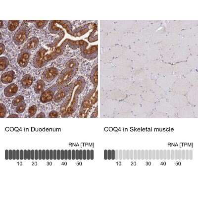 Immunohistochemistry-Paraffin: COQ4 Antibody [NBP1-91806]