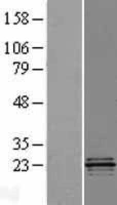 Western Blot: COQ4 Overexpression Lysate [NBP2-07097]