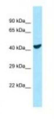 Western Blot: COQ6 Antibody [NBP1-98412]