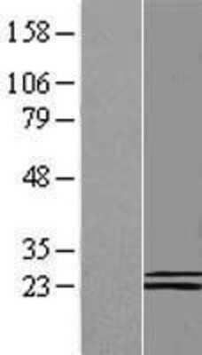 Western Blot: COQ6 Overexpression Lysate [NBP2-04865]