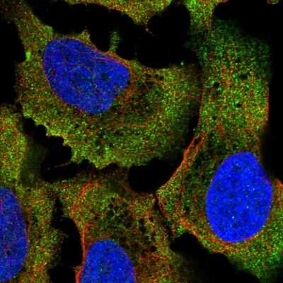 Immunocytochemistry/ Immunofluorescence: COQ7 Antibody [NBP2-57950]