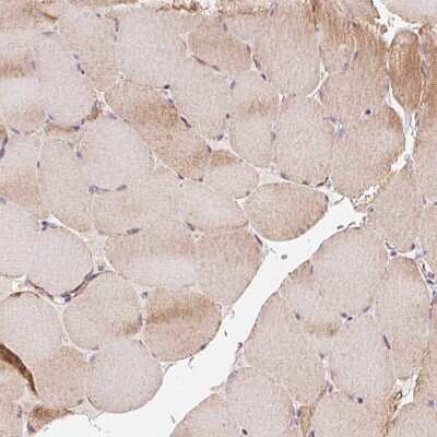 Immunohistochemistry-Paraffin: COQ7 Antibody [NBP2-39084]