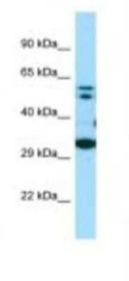 Western Blot: COQ7 Antibody [NBP1-98496]