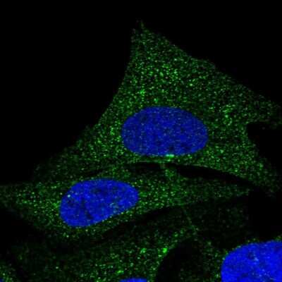 Immunocytochemistry/ Immunofluorescence: COQ9 Antibody [NBP1-88450]