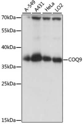 Western Blot: COQ9 AntibodyAzide and BSA Free [NBP2-92239]