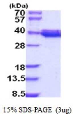 SDS-PAGE: Recombinant Human COQ9 His Protein [NBP2-52045]