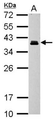 Western Blot: CRX/CORD2 Antibody [NBP2-15964]
