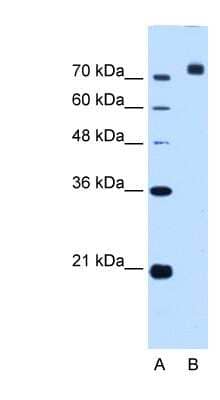 Western Blot: Corin Antibody [NBP1-59663]