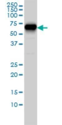 Western Blot: CORO1B Antibody (1E7) [H00057175-M01]